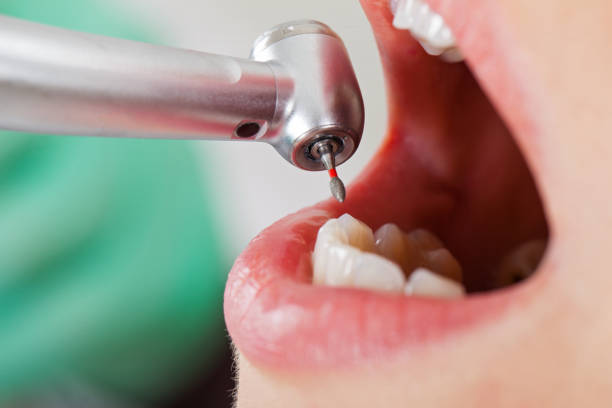 Best Emergency Tooth Extraction  in Wathena, KS